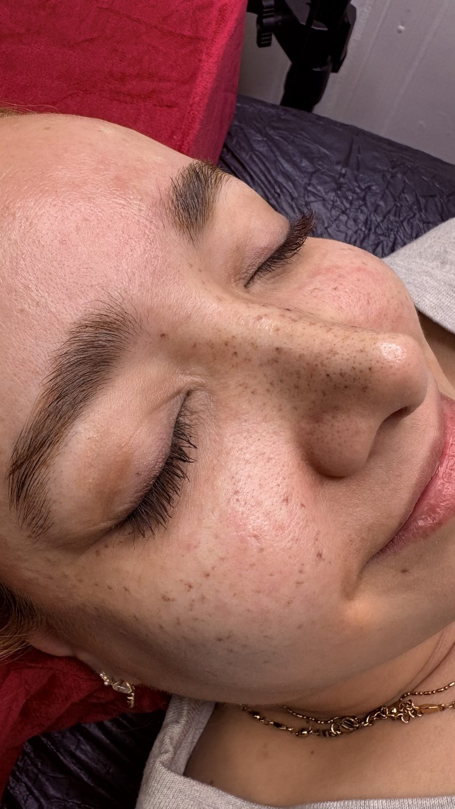 Sommersprossen bei Soufi Beauty in Dresden