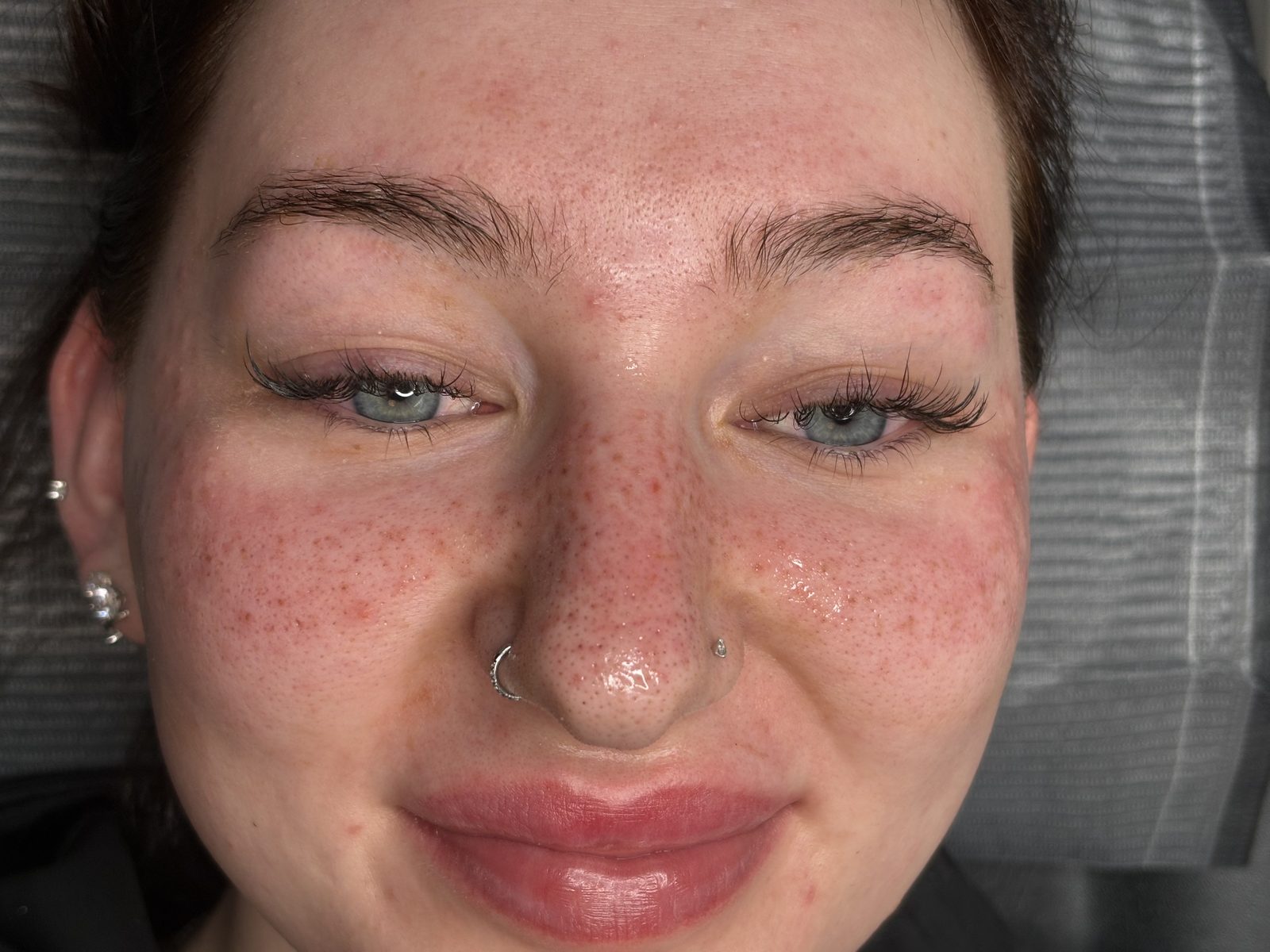 Sommersprossen — Arbeit von Soufi Beauty, Bild 5